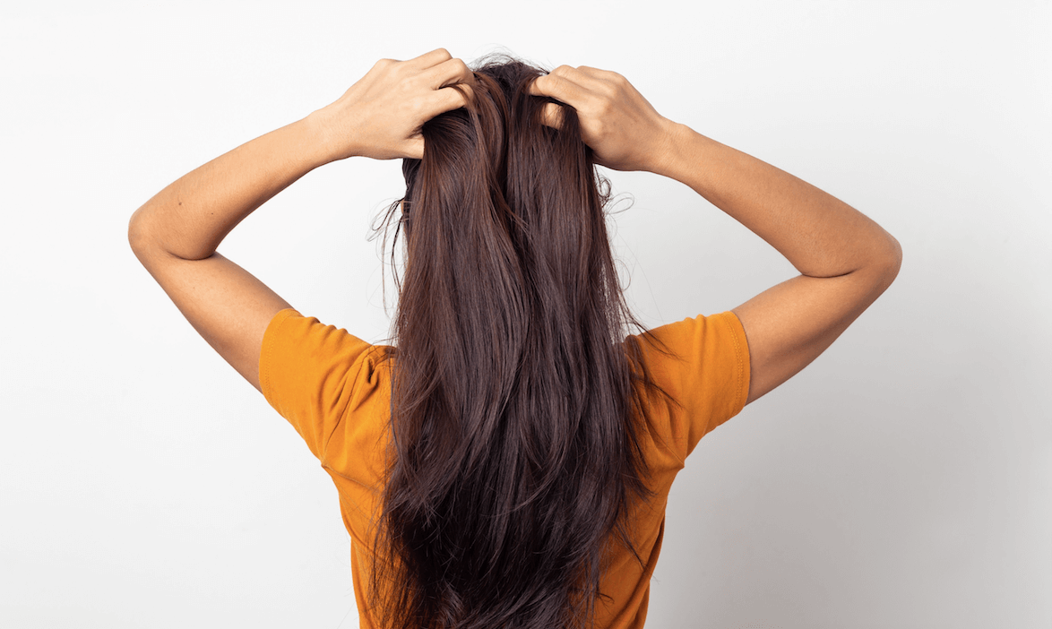 TIP 8 - Ako sa starať o vlasy s lupinami a svrbivú pokožku hlavy